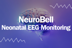 The Neuro Science Monitor (Moberg Analytics) NeuroBell Neonatal EEG Monitoring