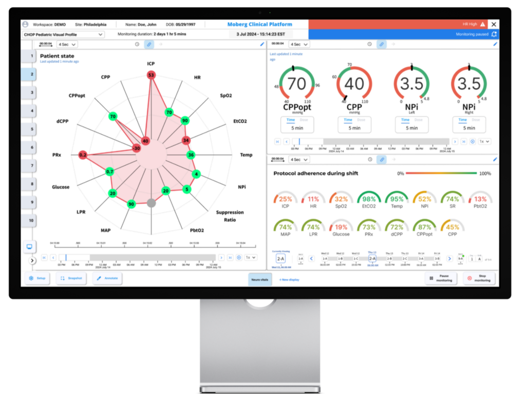 Moberg Clinical Platform Demo