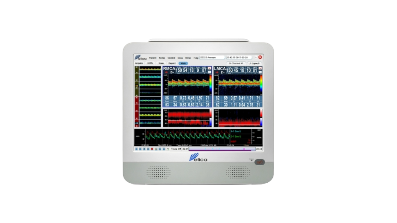 Multigon / Delica TCD System