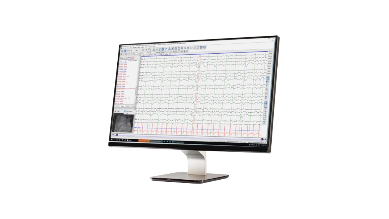 Natus NeuroWorks EEG
