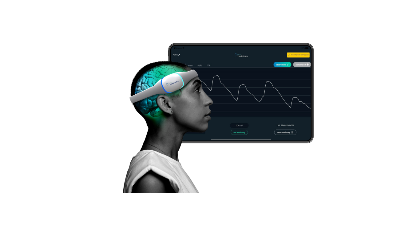 brain4care brain monitor