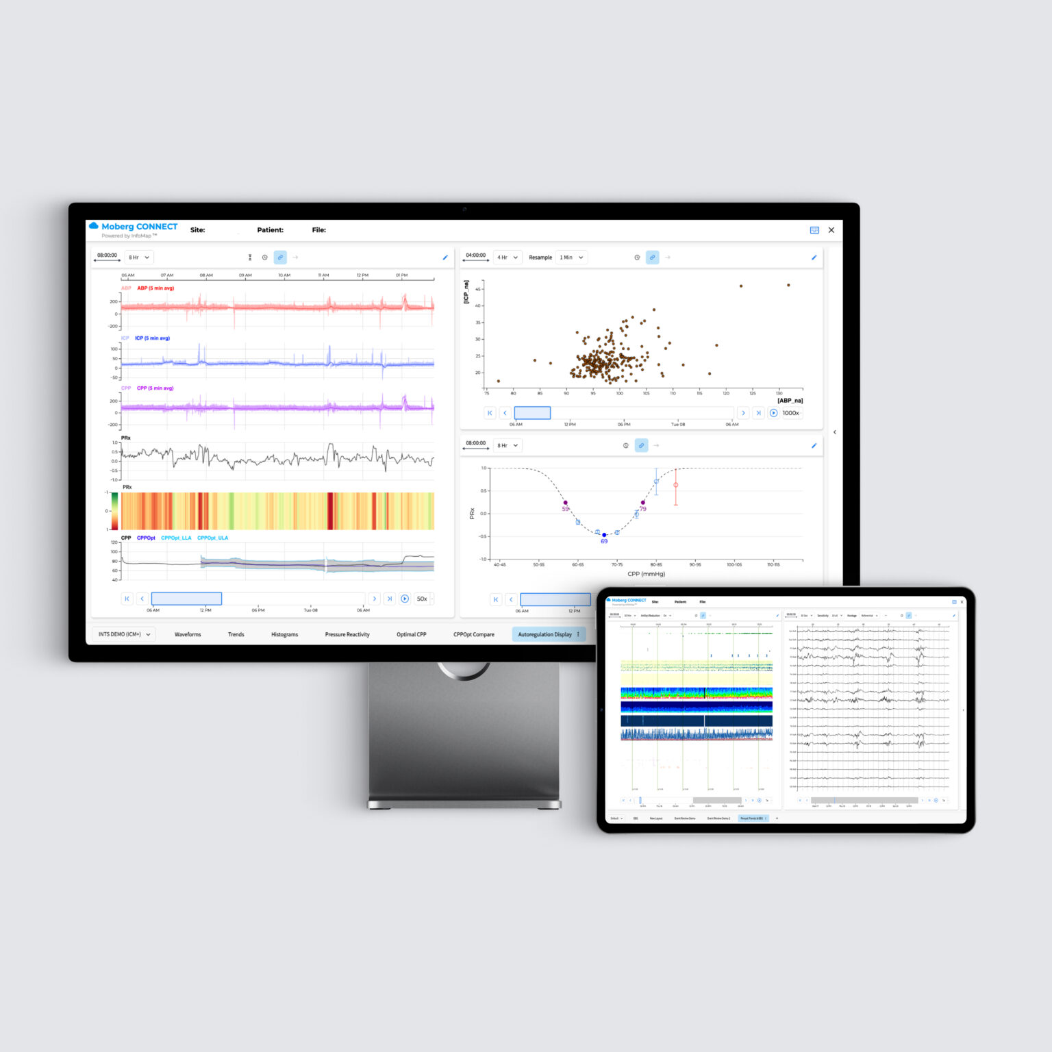 MCP Patient Dashboard | Improved Patient Monitoring