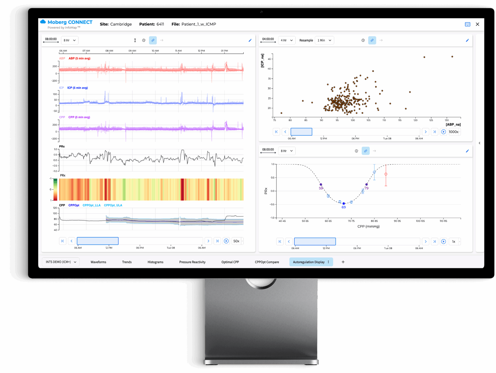 the moberg analytics Moberg Clinical Platform (MCP) Bedside Dashboard: Analyze Data