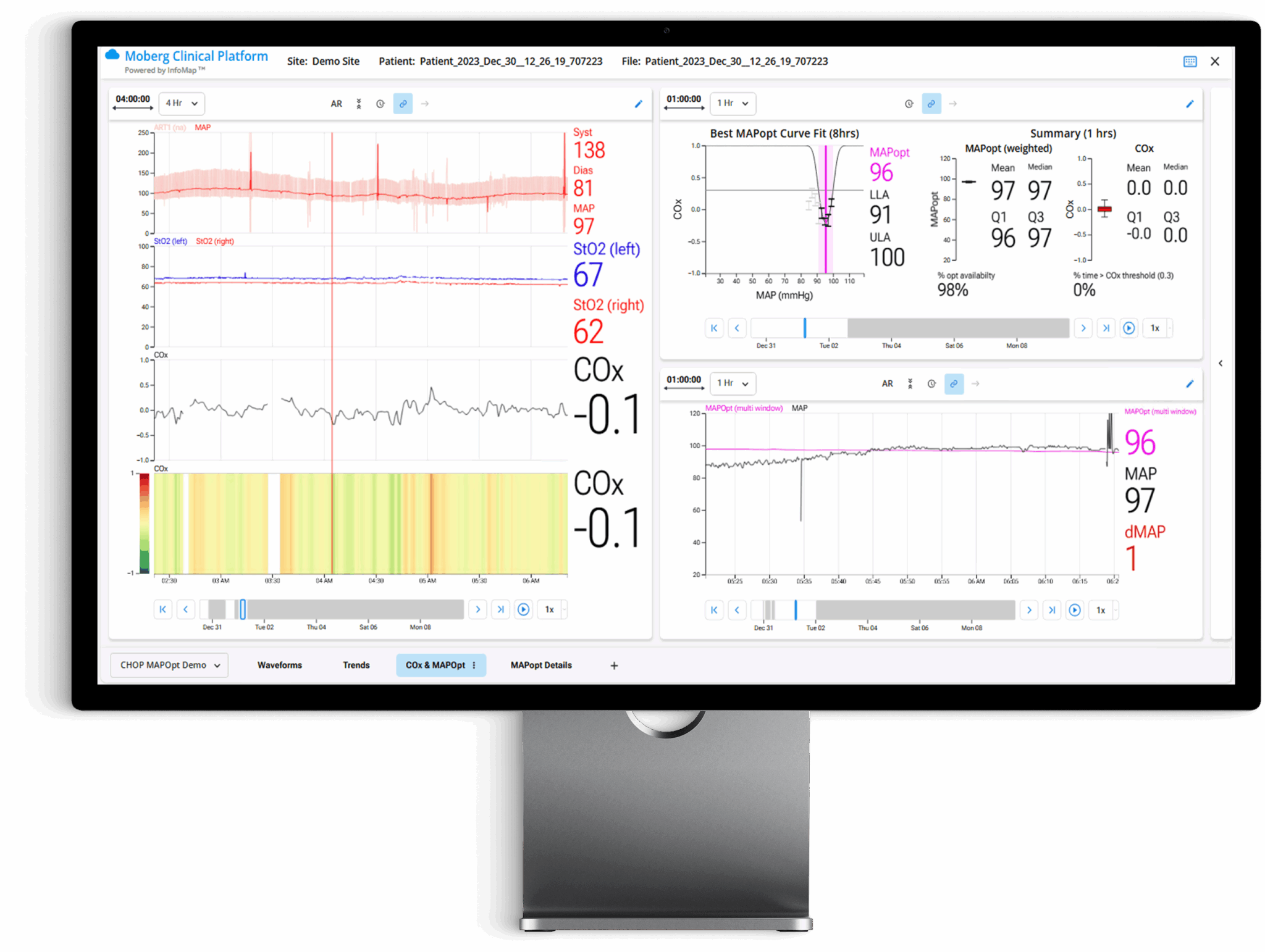 the moberg analytics Moberg Clinical Platform (MCP) Bedside Dashboard: Analyze Data