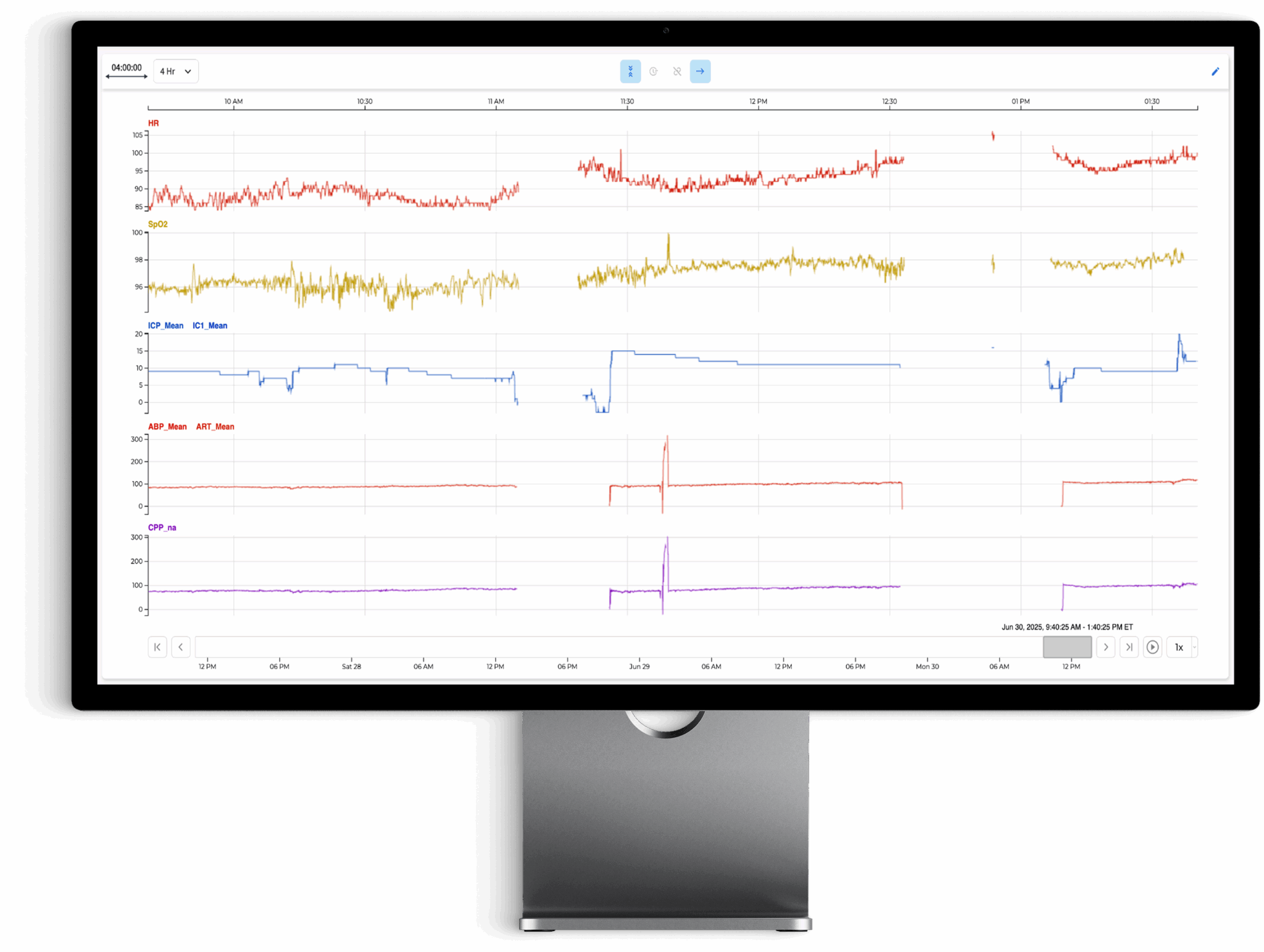 the moberg analytics Moberg Clinical Platform (MCP) Bedside Dashboard: Review Multimodal Data
