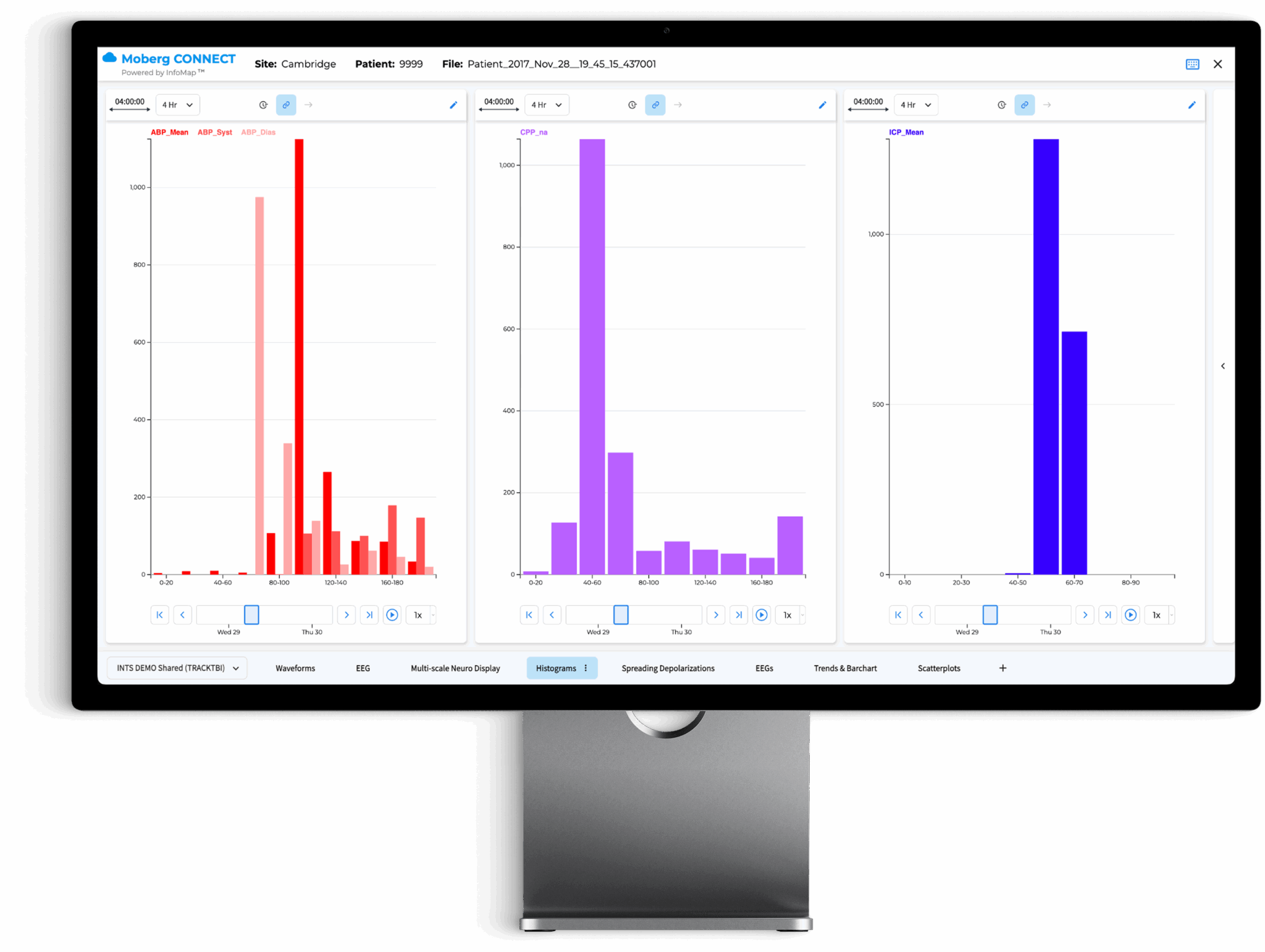 the moberg analytics Moberg Clinical Platform (MCP) Bedside Dashboard: Review Multimodal Data