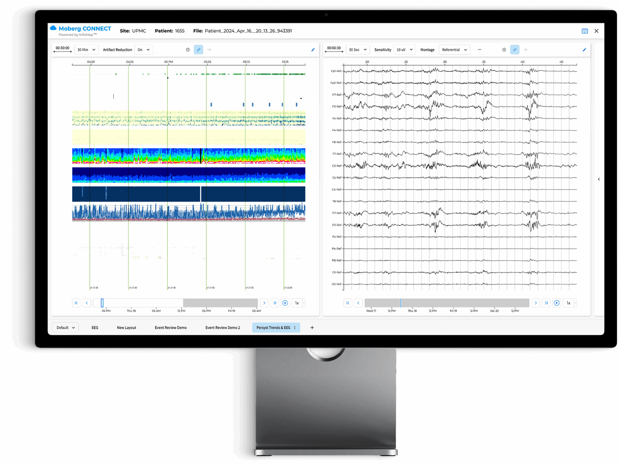 the moberg analytics Moberg Clinical Platform (MCP) Bedside Dashboard: review multimodal data